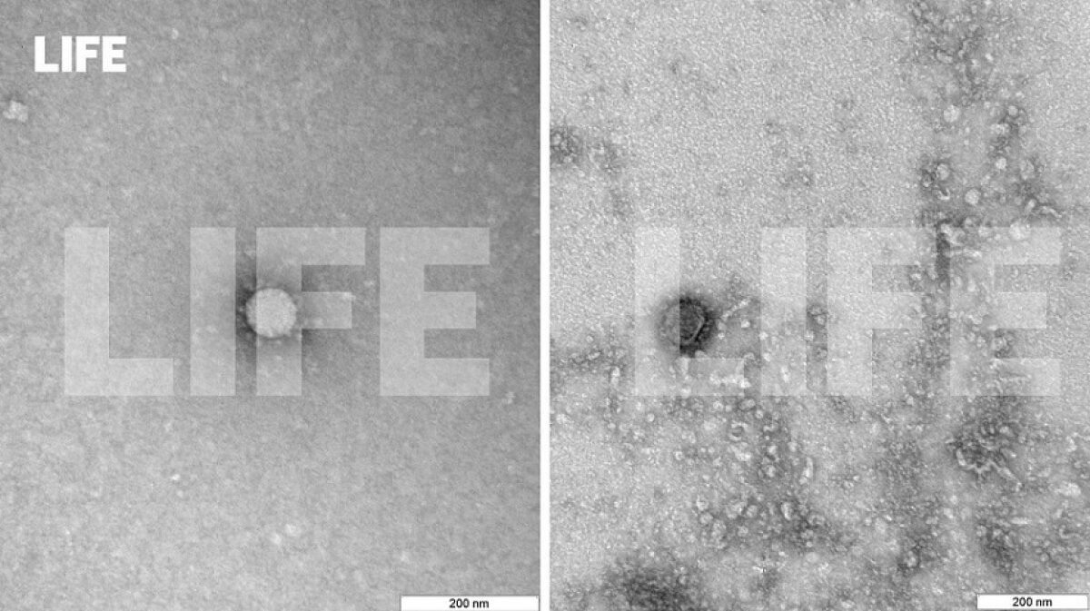Первые снимки коронавируса, сделанные российскими ученными, попали в Сеть