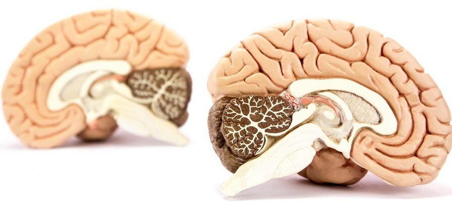 Ученые рассказали, что человеку достаточно половины мозга для сохранения умственных способностей