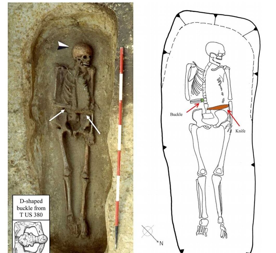 В Италии археологи наткнулись на скелет мужчины, у которого вместо правой руки был вживлен протез 