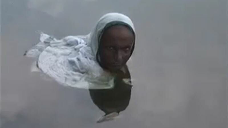 Женщина-русалка в Индии: аномальный недуг заставляет индианку проводит целые сутки в воде
