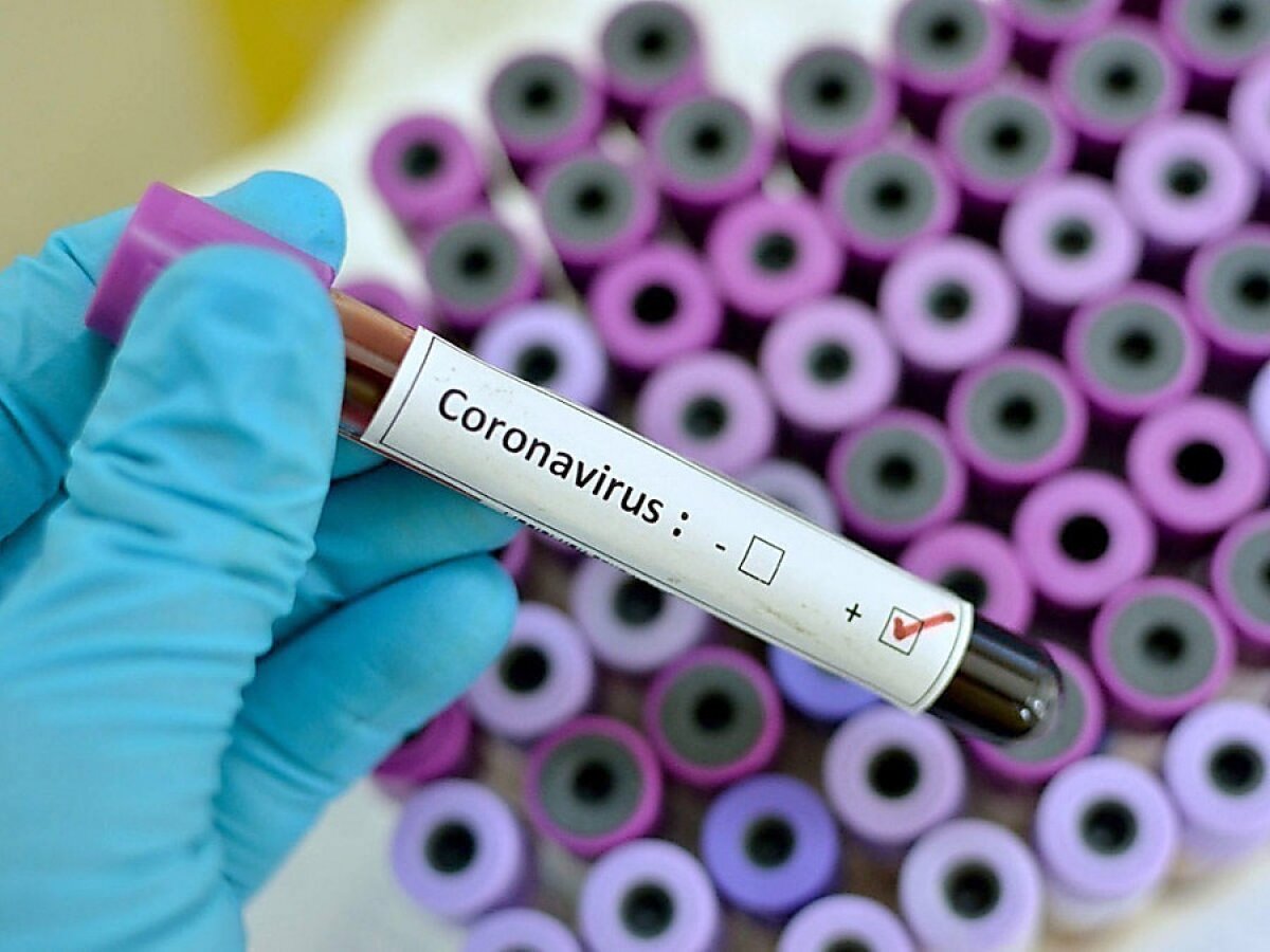 "Может быть, не беременеть", - академик Малеев предупредил о новой угрозе коронавируса