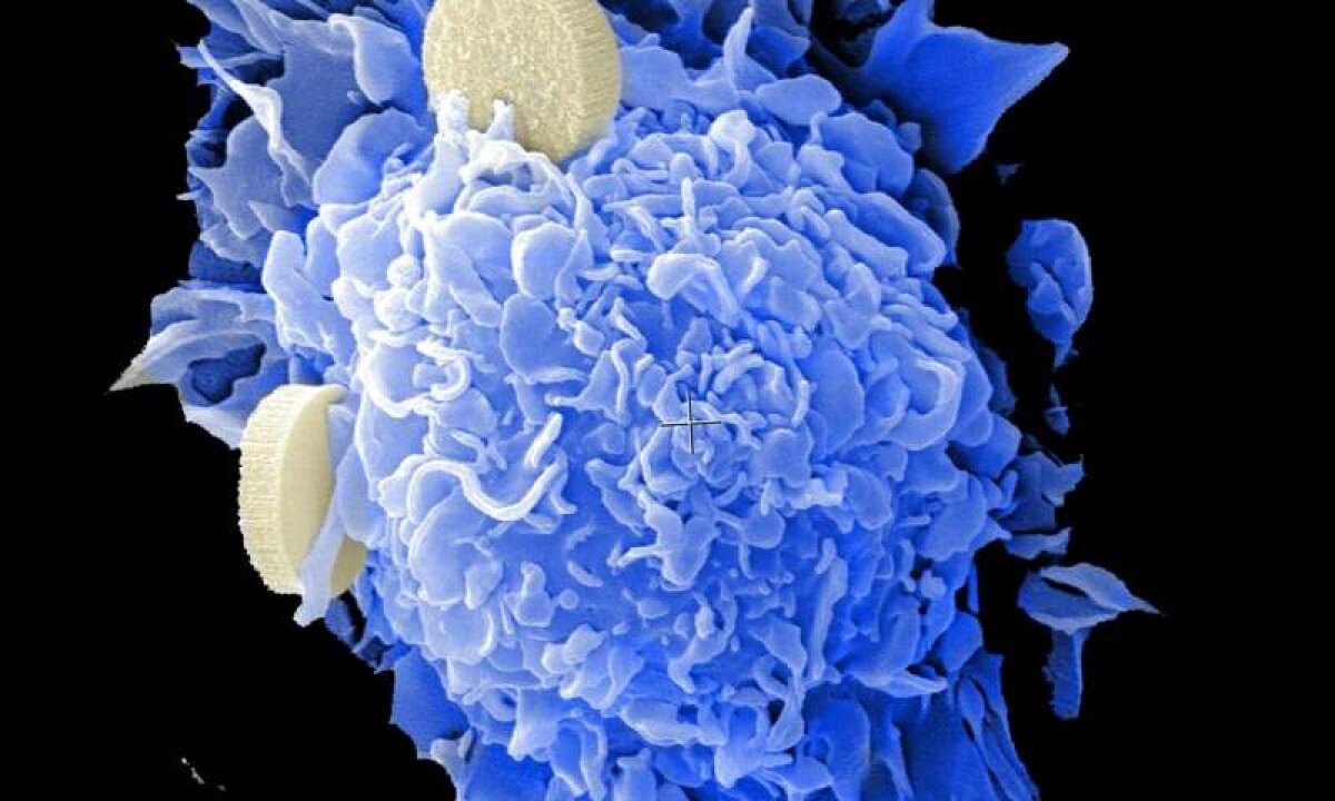 ​Биологи назвали естественное вещество, убивающее раковые клетки: проведены исследования