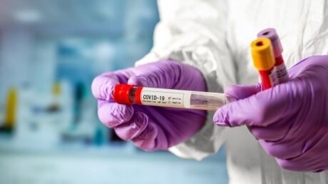 Ученые из США назвали фактор, повышающий риск смерти при коронавирусе