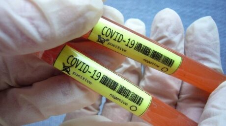 Россия нашла лекарство от коронавируса - известно название