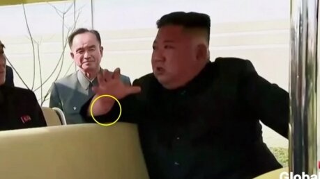 Ким Чен Ын засветил таинственный след на запястье 