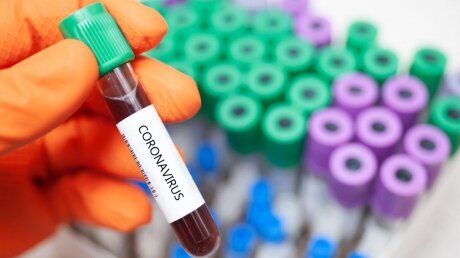 США приближаются к критической отметке из-за количества смертей от коронавируса – новые данные