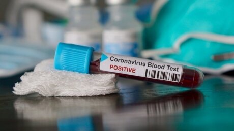 На Украине возросло число заразившихся COVID-19 – данные на 3 апреля