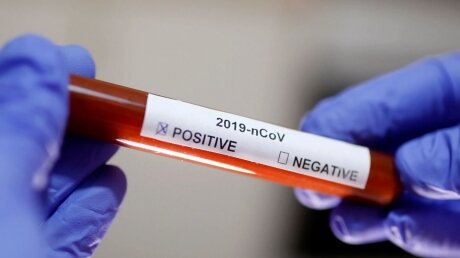 МИД Китая: за мировой пандемией коронавируса могут стоят США