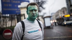 навальный, россия, нападение, оппозиция, кремль, не прессовать 